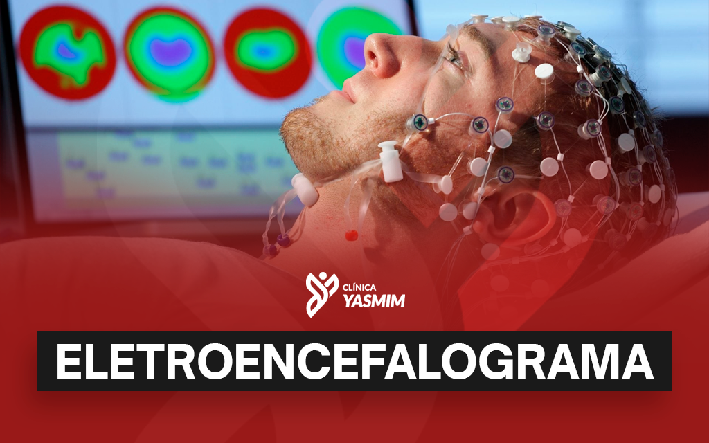 a imagem mostra um homem deitado com sensores no cabelo, com o título de "eletroencefalograma"