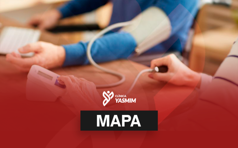 a imagem mostra o braço de uma pessoa sendo monitorado por um MAPA