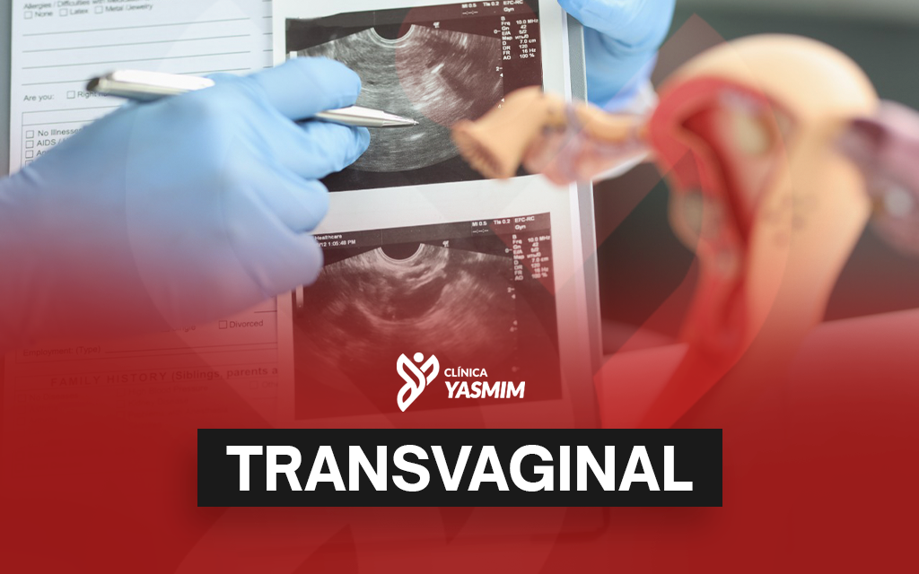 a imadem mostra uma mão com luvas azuis mostrando um ultrassom transvaginal impresso