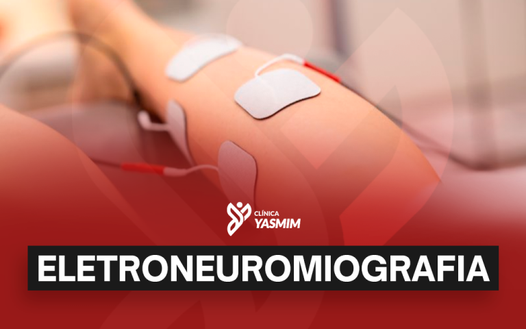 a imagem mostra uma panturrilha ligada a sensores, com o título "eletroneuromiografia" escrito embaixo