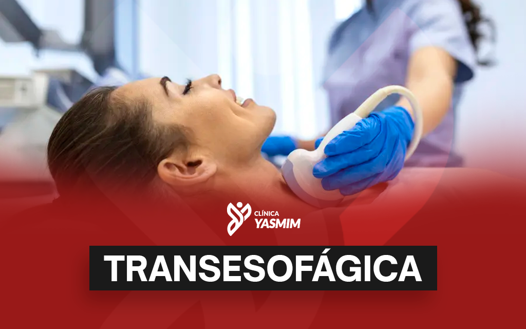 a imagem mostra uma mulher sendo avaliada por um ultrassom transesofágico