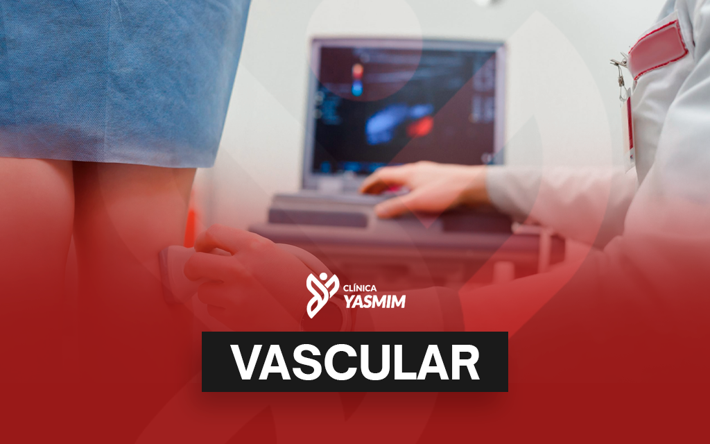 a imagem mostra um ultrassom vascular sendo realizado