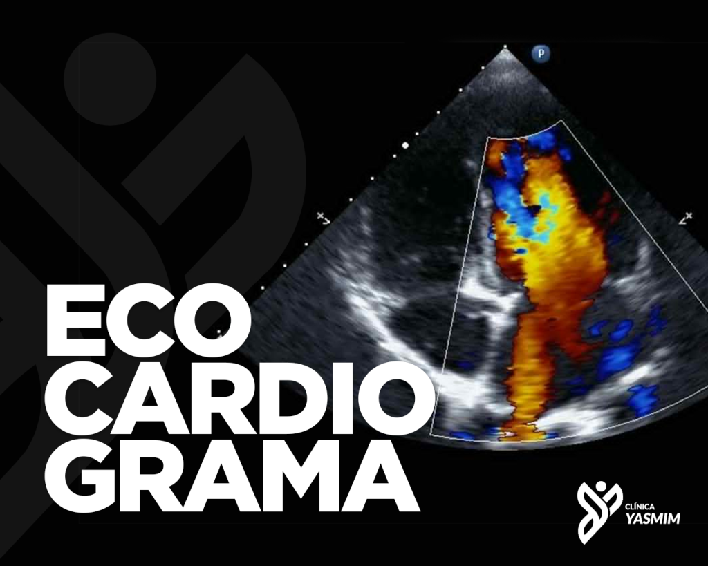 Imagem de uma ultrassonografia com o texto "ecocardiograma" no canto esquerdo