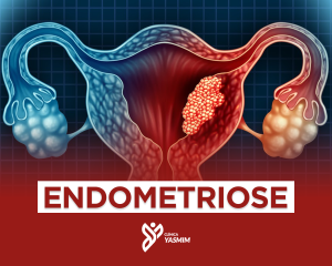 a imagem mostra uma ilustração do útero, trompas e ovários, abaixo está escrito "endometriose"