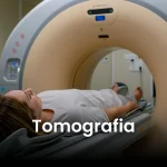 Tomografia em Anapolis